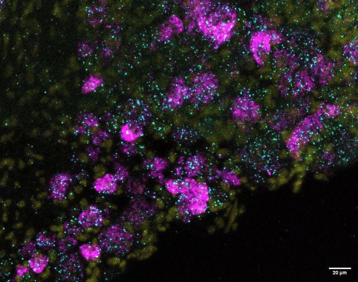 Descubierta una nueva proteína que interviene en el sentido del tacto | Ciencia