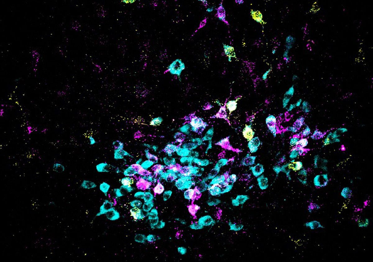 El miedo emerge de cambios químicos en lo más profundo del cerebro | Ciencia