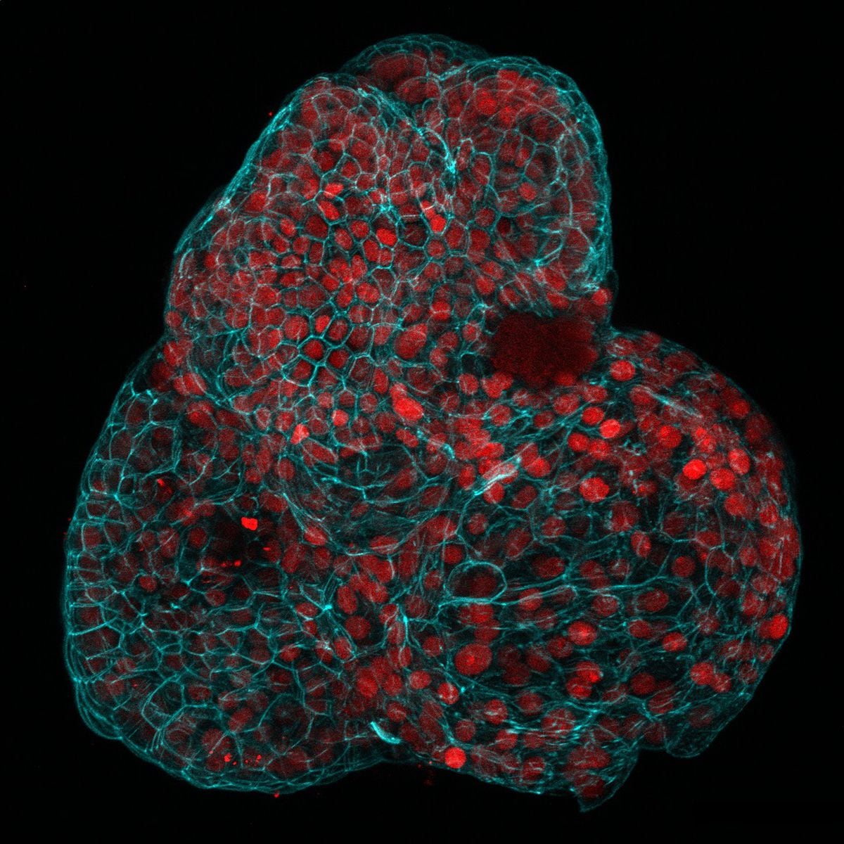 Miniórganos humanos creados con células fetales permiten tratar enfermedades antes de nacer | Ciencia